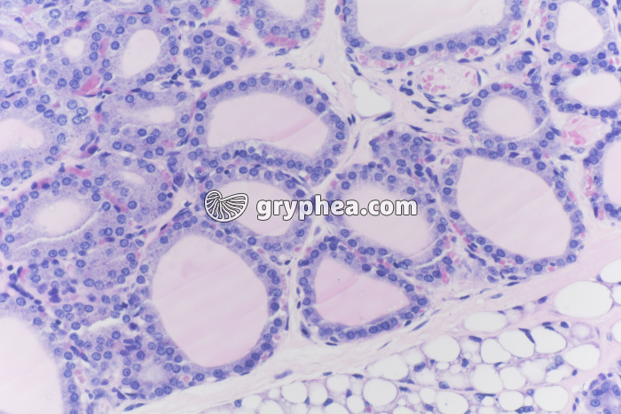 Thyroïde en hyperactivité x100 - gryphea.com